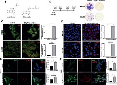 Lucanthone Targets Lysosomes to Perturb Glioma Proliferation, Chemoresistance and Stemness, and Slows Tumor Growth In Vivo